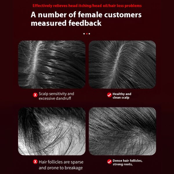 Electric Hair Regrowth Brush Anti-Hair Loss – Image 2